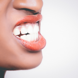 Are Gaps Bad for Your Teeth?