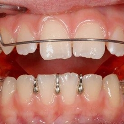 Orthodontic Technology Advancements in Dentofacial Orthopedics ChatGPT